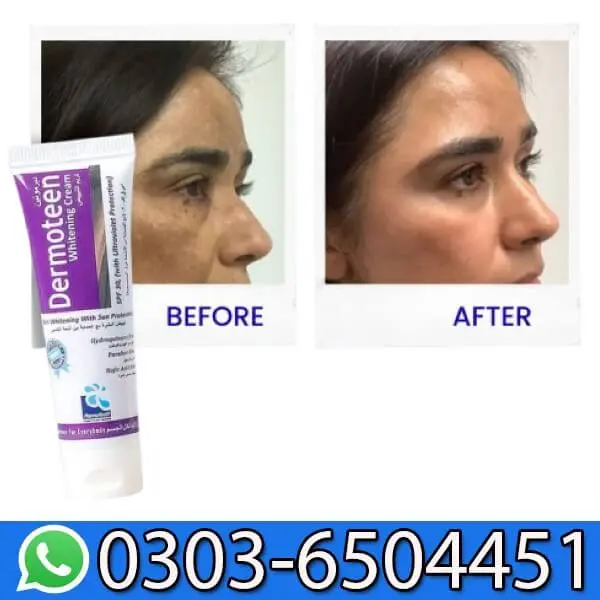 Dermoteen Cream Make Skin Glowing Fair Radiant & Smooth In Pakistan