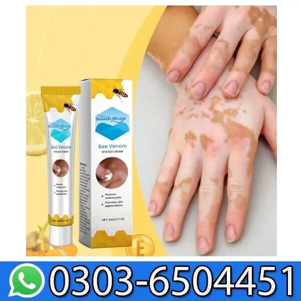 South Moon Bee Venom Vitiligo Cream In Pakistan