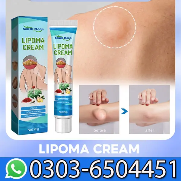 South Moon Lipoma Cream Price in Pakistan