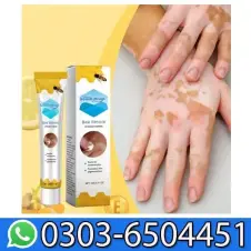 South Moon Bee Venom Vitiligo Cream In Pakistan