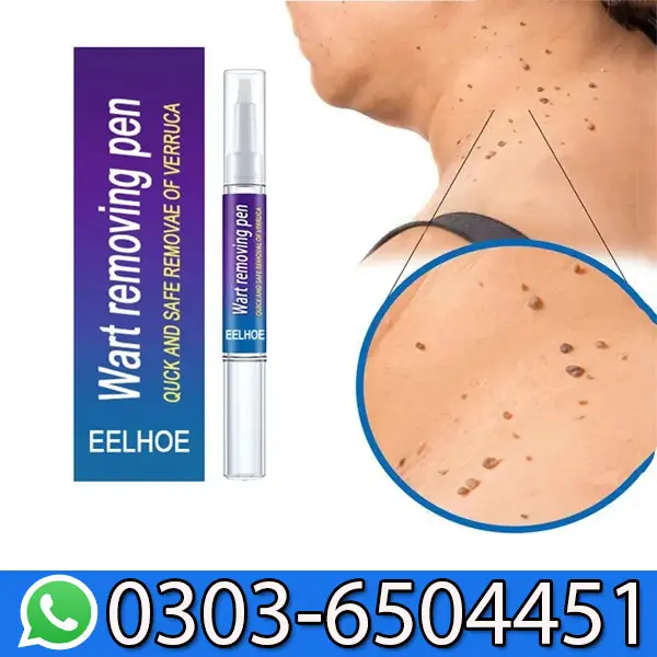 Wart Removing Pen